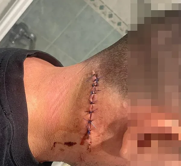 Brutal pelea en un bar con dos apuñalados